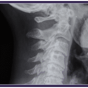 diagnostic X-ray