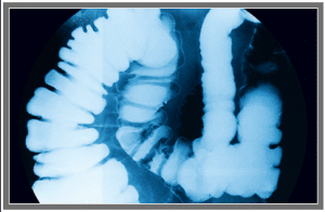 ServiceTrak Radiographic Fluoroscopy - IMV Medical Information Division